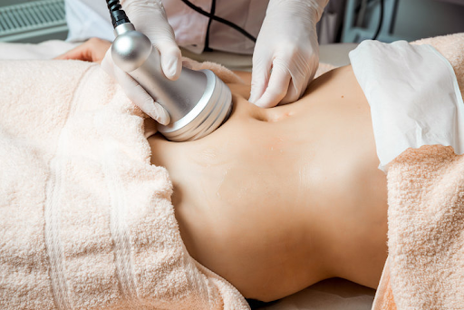 Body contouring surgery
